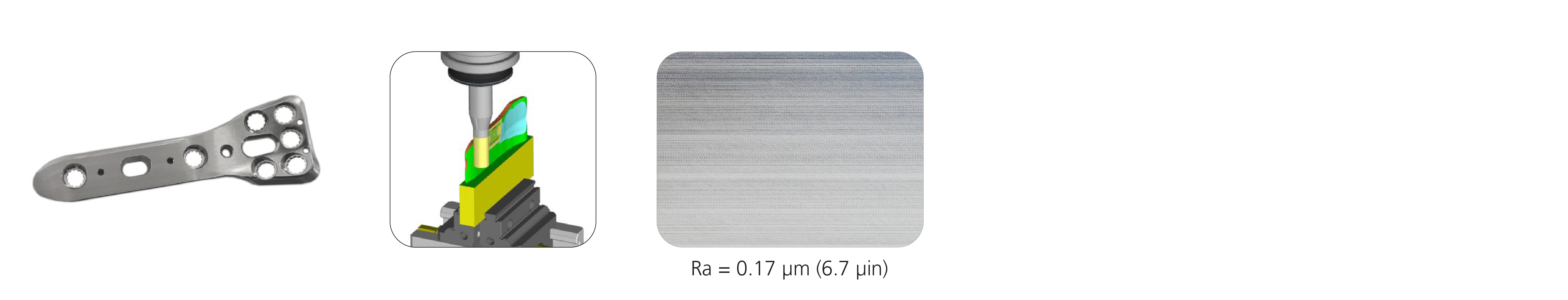 radius compression plate